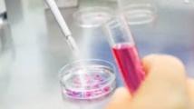Découverte de mutations génétiques réduisant le risque cardio-vasculaire Découverte de mutations génétiques réduisant le risque cardio-vasculaire