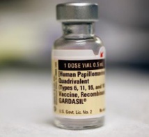 Papillomavirus: pas de lien entre le vaccin et l’apparition de phlébite Papillomavirus: pas de lien entre le vaccin et l’apparition de phlébite