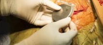 Injecter un gène dans un muscle pourrait remplacer le pacemaker Injecter un gène dans un muscle pourrait remplacer le pacemaker
