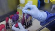 Sida: Des protéines responsables de l'inefficacité des microbicides Sida: Des protéines responsables de l'inefficacité des microbicides
