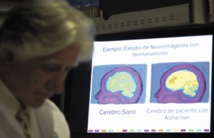 En Colombie, une "malédiction" pour guérir la planète d'Alzheimer En Colombie, une "malédiction" pour guérir la planète d'Alzheimer