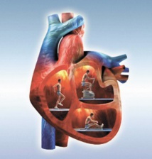 La Chine risque une épidémie de maladies cardiovasculaires La Chine risque une épidémie de maladies cardiovasculaires