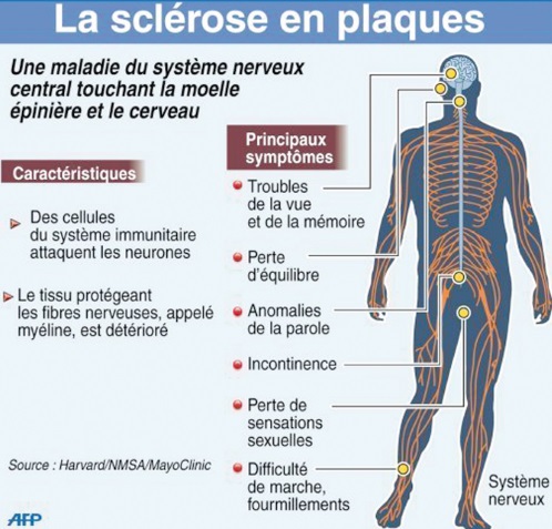 ​La sclérose en plaques, cette maladie qui s’attaque au cerveau et à la moelle épinière : Sauvons Imane Amahzoune !