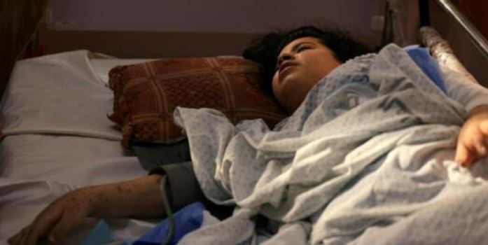 "Rattachez moi mes jambes" : l'effroi des enfants amputés dans Gaza en guerre "Rattachez moi mes jambes" : l'effroi des enfants amputés dans Gaza en guerre