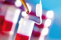 Un test ADN du sang de la mère plus efficace pour dépister la trisomie d'un foetus Un test ADN du sang de la mère plus efficace pour dépister la trisomie d'un foetus