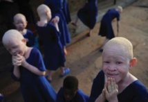 Albinos en Tanzanie, une vie de stigmatisation et de violence Albinos en Tanzanie, une vie de stigmatisation et de violence