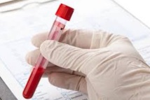 Un test sanguin pourrait prédire une rechute d'un cancer du sein