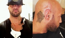 Booba blessé au crâne par Dam16 Booba blessé au crâne par Dam16