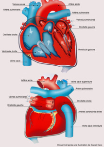 Nouveau test sanguin pour identifier les patients à très faible risque d’infractus Nouveau test sanguin pour identifier les patients à très faible risque d’infractus