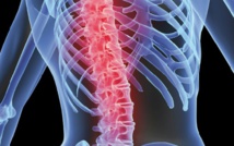 L’ostéoporose touche 30% de Marocains L’ostéoporose touche 30% de Marocains