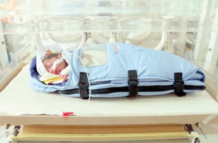 Les taux de naissances prématurées en hausse à travers le monde Les taux de naissances prématurées en hausse à travers le monde