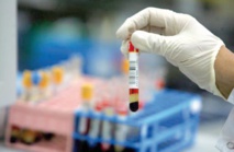 8% des Marocains touchés par les maladies auto-immunes rares 8% des Marocains touchés par les maladies auto-immunes rares