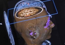 Avoir un gros cerveau ne serait pas une bonne nouvelle Avoir un gros cerveau ne serait pas une bonne nouvelle