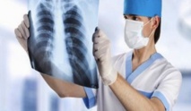 Présentation du livre “Le cancer broncho-pulmonaire non à petites cellules, connaissances et pratique”