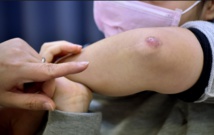 "Kumitaiso", des milliers d'enfants japonais aux urgences