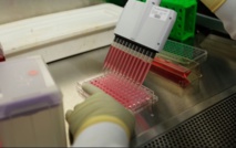 Des anticorps protègent des singes du "VIH" pendant des mois Des anticorps protègent des singes du "VIH" pendant des mois