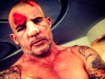 Dominic Purcell sévèrement  blessé sur le tournage de Prison Break au Maroc 