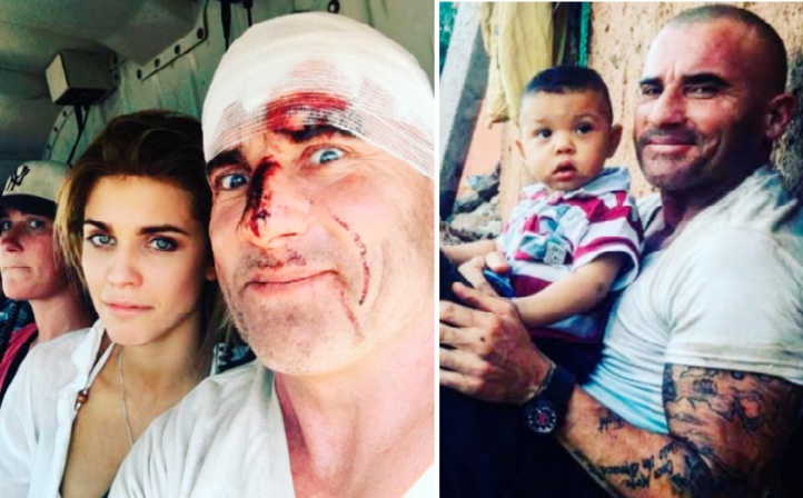 Dominic Purcell déplore l’état des hôpitaux marocains