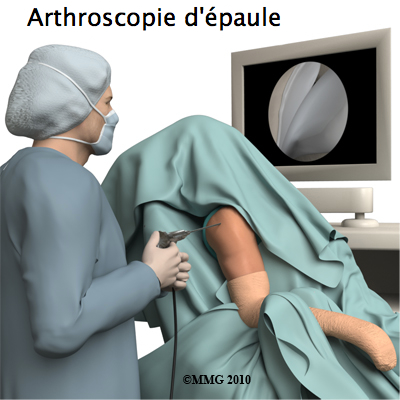 Les nouvelles techniques thérapeutiques en arthroscopie disséquées à Marrakech
