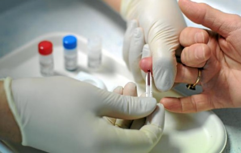 Appel au respect des droits de l’Homme pour le dépistage du VIH dans les établissements pénitentiaires Appel au respect des droits de l’Homme pour le dépistage du VIH dans les établissements pénitentiaires