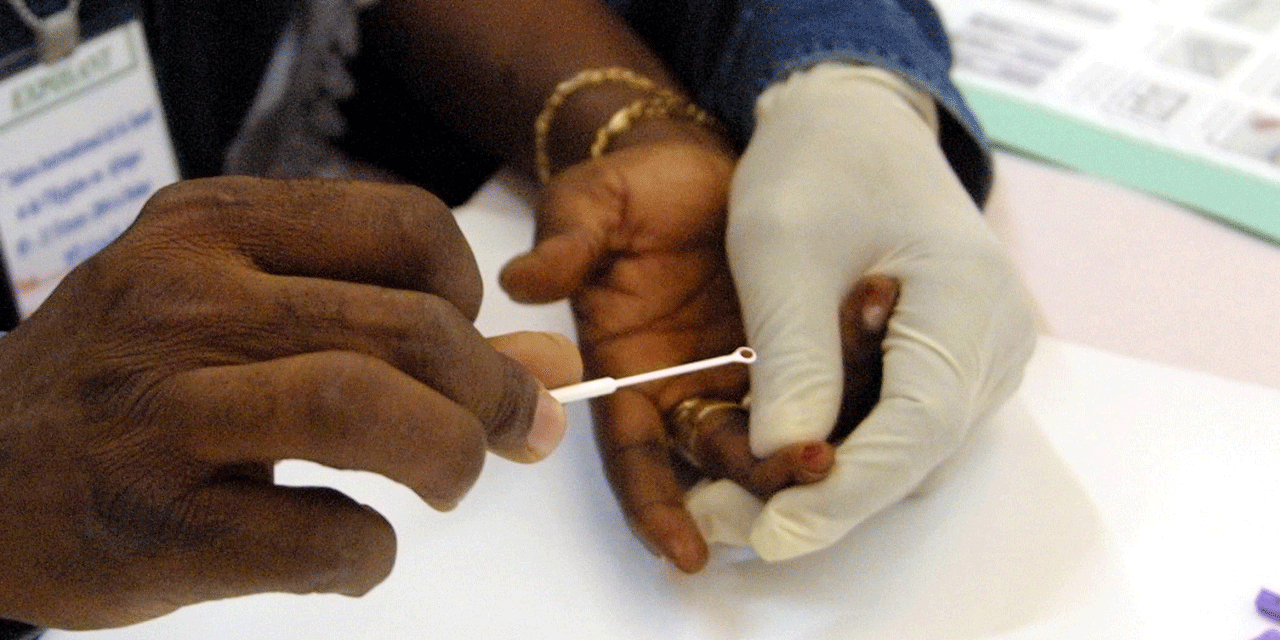 Un test promet  d'améliorer le dépistage de la drépanocytose Un test promet  d'améliorer le dépistage de la drépanocytose