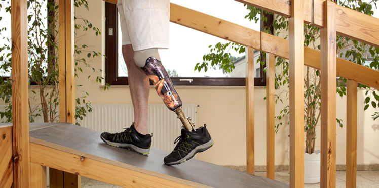 Une imprimante  3D pour fabriquer les prothèses de Handicap international