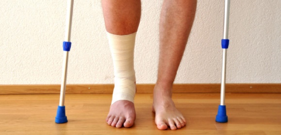 Réponses d’experts : Qu'est-ce qu'une fracture de fatigue?