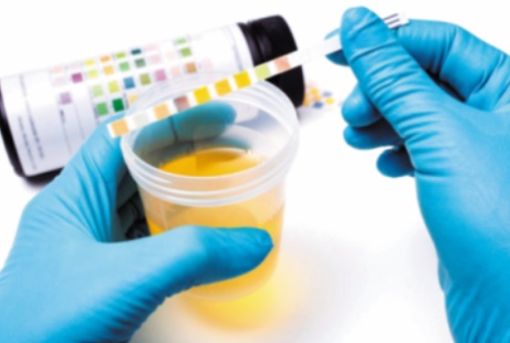 Réponses d’expert : L’infection de la prostate peut-elle rendre stérile ?
