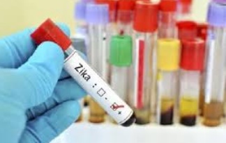 Un cocktail d'anticorps bloque le virus Zika chez des singes