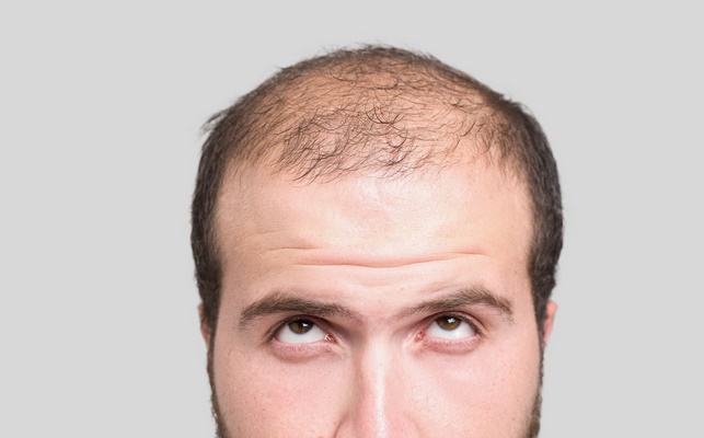 Méthode de culture ultra-rapide des cheveux
