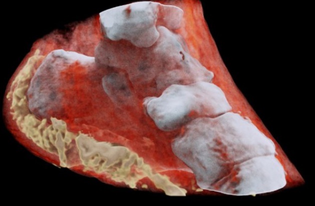 Première radiographie couleur 3D d'un humain