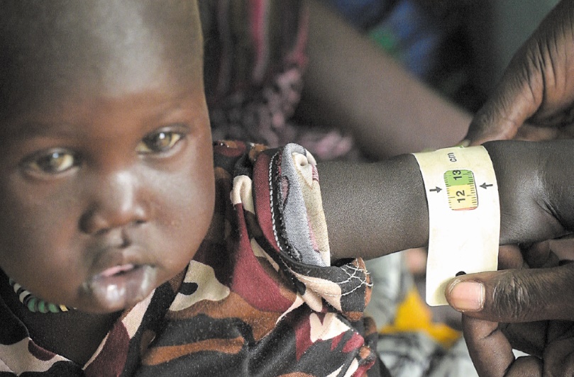 Au Soudan du Sud, les maladies sont aussi mortelles que la guerre