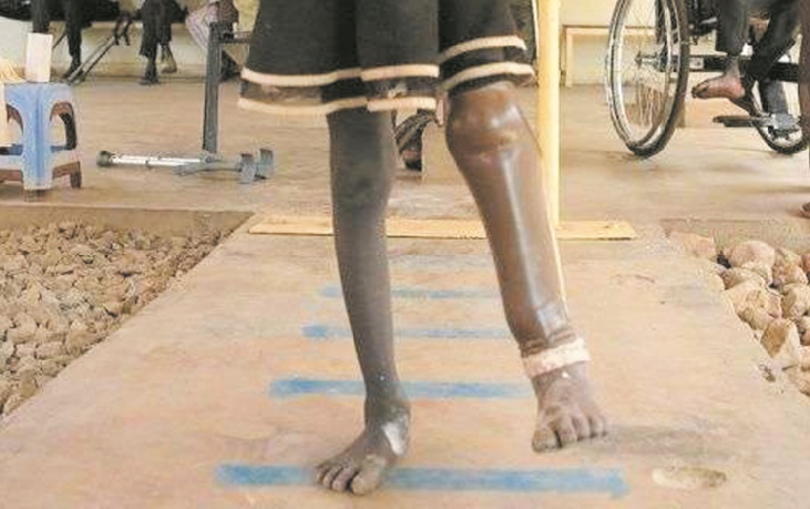 Nouveaux membres et nouvelle vie pour les amputés du Soudan du Sud