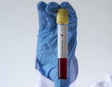 Deux nouveaux cas d'infection au Covid-19