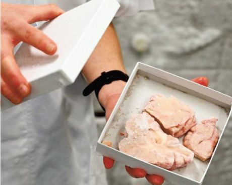 Au Danemark, le passé glaçant de la plus grande collection de cerveaux au monde Au Danemark, le passé glaçant de la plus grande collection de cerveaux au monde