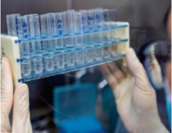 Sclérose en plaque. Une mutation génétique semble jouer un rôle dans son évolution