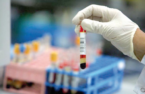8% des Marocains touchés par les maladies auto-immunes rares