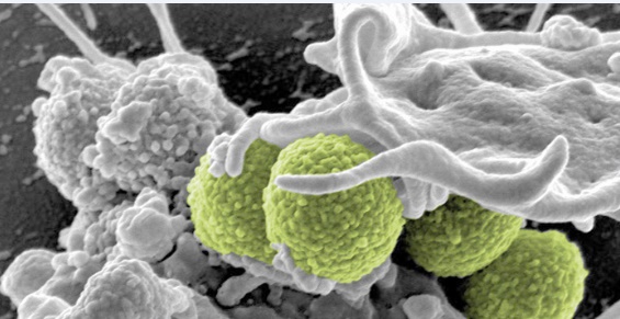 Contrôle des maladies transmissibles et émergentes