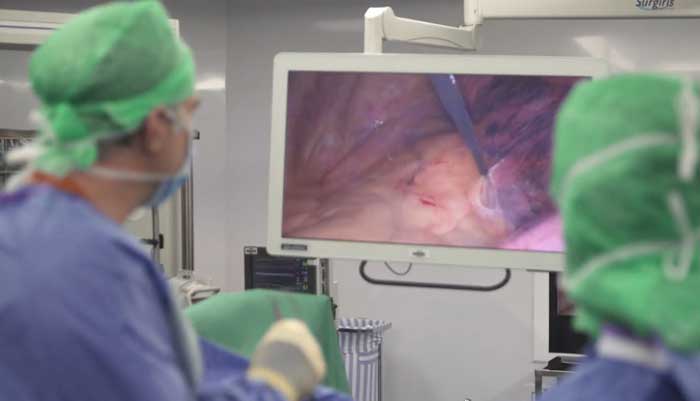 Le diagnostic précoce, facteur déterminant dans la lutte contre le cancer du poumon