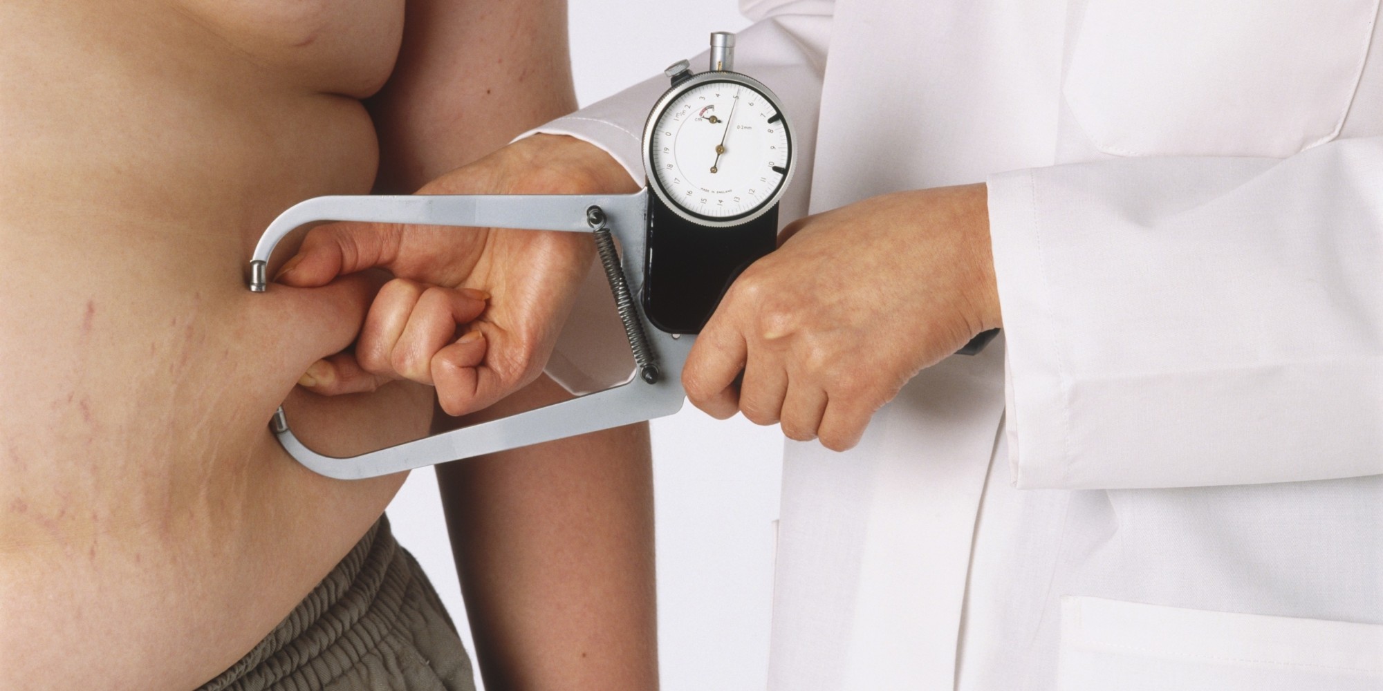 Quand les kilos en trop s'accumulent, l'espérance de vie se réduit