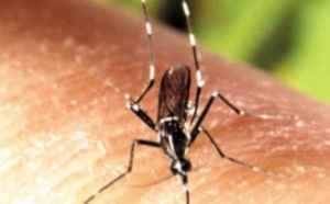 Le Zika pourrait aussi attaquer le cerveau adulte