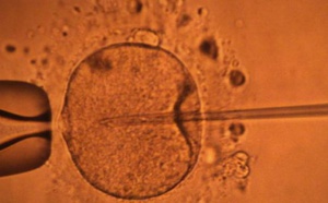 Des ovules créés en laboratoire à partir de cellules souches