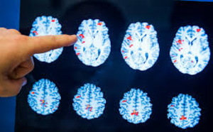 La zone clé du cerveau pour reconnaître  les visages grossit  jusqu'à l'âge adulte