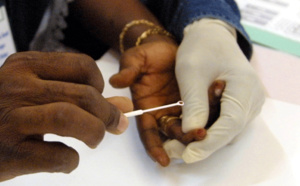 Un test promet  d'améliorer le dépistage de la drépanocytose