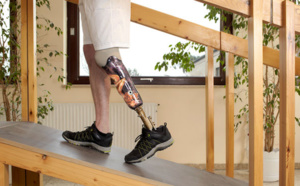 Une imprimante  3D pour fabriquer les prothèses de Handicap international