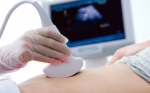 Réponses d’experts : Comment se déroule une échographie du cœur?
