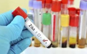 Un cocktail d'anticorps bloque le virus Zika chez des singes