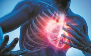 La grippe accroît fortement le risque de crise cardiaque