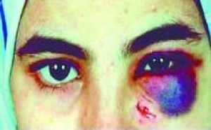 La violence contre les femmes dénoncée par des victimes : La parole libérée