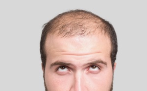 Méthode de culture ultra-rapide des cheveux